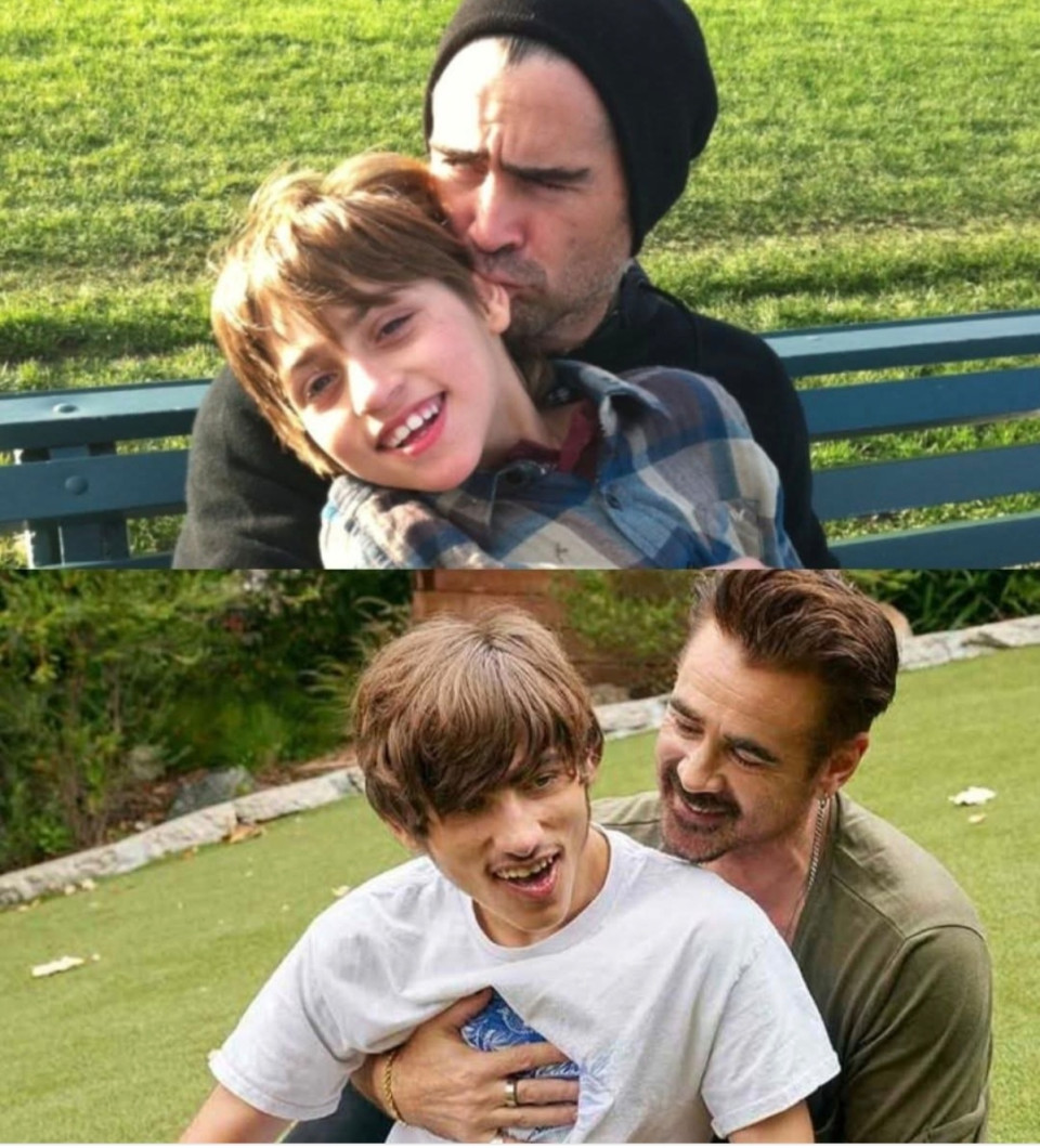 Amikor Colin Farrell, 2003-ban először a karjába vette újszülött fiát Jamest, valami furcsa csend ült a szobára. A nővérek mosolyogtak, de a szemük szomorú volt. A kisfiú nem sírt, nem mozgott sokat, csak nézett, nagy mély szemekkel, mintha már tudta volna, hogy nehéz út vár rá.Néhány nappal később kimondták a szavakat: Angelman-szindróma. Egy ritka genetikai betegség. Azt mondták, James talán soha nem fog tudni járni vagy beszélni. Talán soha nem fogja azt mondani: „apa.”Colinban ekkor minden megállt. A férfi, aki mindig tudta, mit mondjon, most teljesen elnémult. Később így emlékezett:„Olyan volt, mintha megállt volna a világ. Nem tudtam, mit tegyek, csak azt, hogy soha senkit nem szerettem még ennyire.”Aznap éjjel, a kórházi szobában egy időre, egyedül volt a fiával. A híres, lázadó színész, aki korábban a bulikról és a botrányokról volt híres, most csak egy apa volt. Halkan suttogta a kisfiának:„Rendben van, kisember. Most már csak te és én vagyunk. Itt leszek. Mindig.”És megtartotta a szavát. Letette az alkoholt, hátrahagyta a káoszt, a bulizást, és a hírverést. „Azt hittem, őrület kell ahhoz, hogy éljek”, mondta később. „Aztán rájöttem, hogy csak valakit kellett jobban szeretnem önmagamnál.”James minden apró előrelépése csodának számított. Amikor négyévesen megtette az első lépéseit, Colin sírva fakadt. „Mások akkor éljeneznek, ha a gyerekük aranyérmet nyer”, mondta. Én akkor éljeneztem, amikor az enyém átsétált a szobán.”Ettől kezdve olyan filmekben vállalt szerepet, amelyekben viszontlátta saját csendes küzdelmeit, mint az, Erőszakikban, A homárban,  vagy A sziget szellemeiben. Történeteket bűntudatról, szeretetről és a második esélyekről.Nem játszott többé megváltást, megélte.Ma, ha valaki találkozik vele, nem a vad, botrányos színészt látja, hanem egy férfit, aki a káoszból szeretetet épített.„Régen azt hittem, hogy vadnak lenni azt jelenti, elveszni”.Most már tudom, a legvadabb dolog, amit valaha tettem, az volt, hogy a fiam mellett maradtam.”Sokan B kategóriás színészként emlegetik, annak ellenére, hogy számos kasszasiker filmben szerepelt. Szerintem kiváló színész, és remek ember, mindig szívesen néztem, és remélem még nézhetem a filmjeit. 🎬